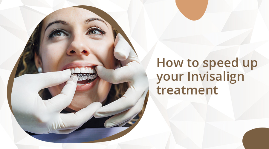 How to Speed Up Your Invisalign Treatment?
