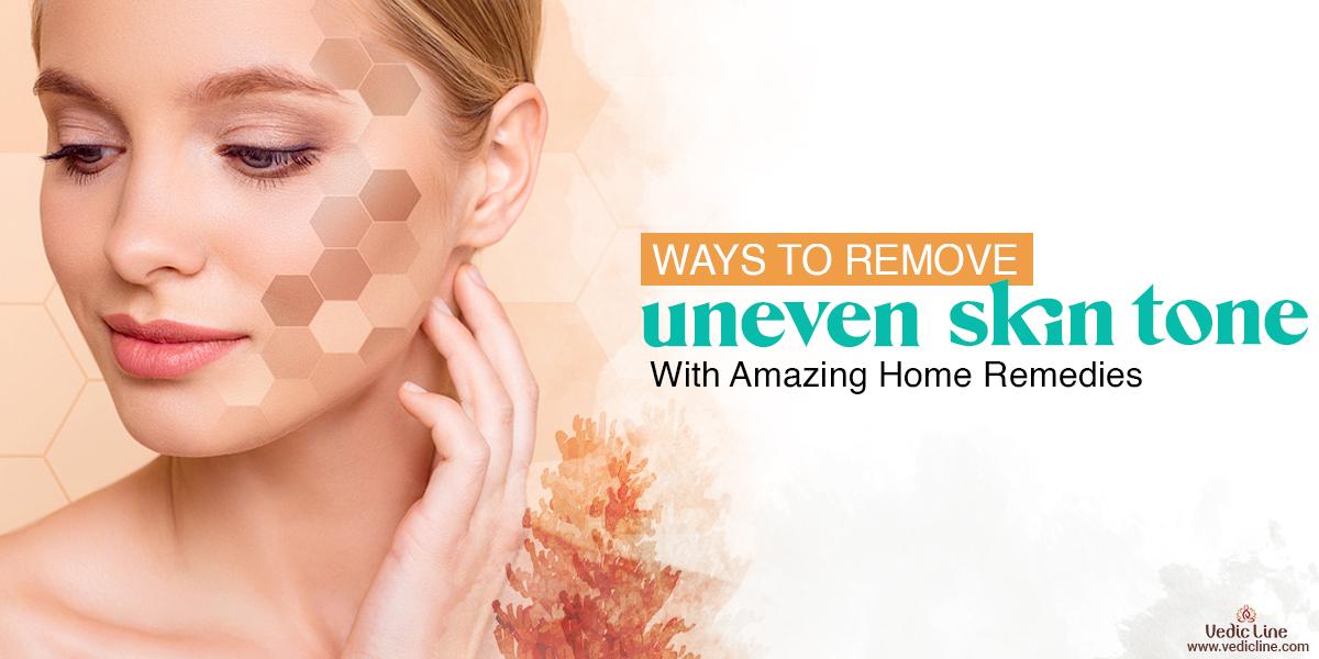 Ways to Remove Uneven Skin Tone With Amazing Home Remedies